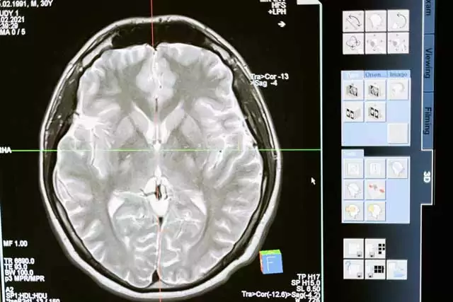 Diagnostic Imaging