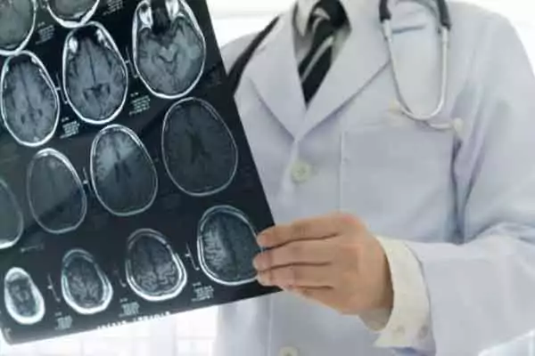 Neurologist